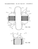 METHODS AND SYSTEMS FOR INCREASING THE BENDING STIFFNESS AND CONSTRAINING     THE SPREADING OF A SPINAL SEGMENT diagram and image