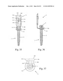 Method and Apparatus for Performing Spinal Surgery diagram and image