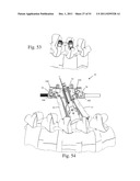 Method and Apparatus for Performing Spinal Surgery diagram and image