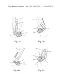 Method and Apparatus for Performing Spinal Surgery diagram and image