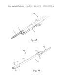 Method and Apparatus for Performing Spinal Surgery diagram and image