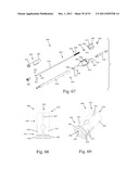 Method and Apparatus for Performing Spinal Surgery diagram and image