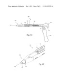 Method and Apparatus for Performing Spinal Surgery diagram and image