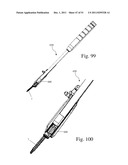 Method and Apparatus for Performing Spinal Surgery diagram and image