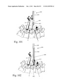 Method and Apparatus for Performing Spinal Surgery diagram and image