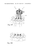 Method and Apparatus for Performing Spinal Surgery diagram and image