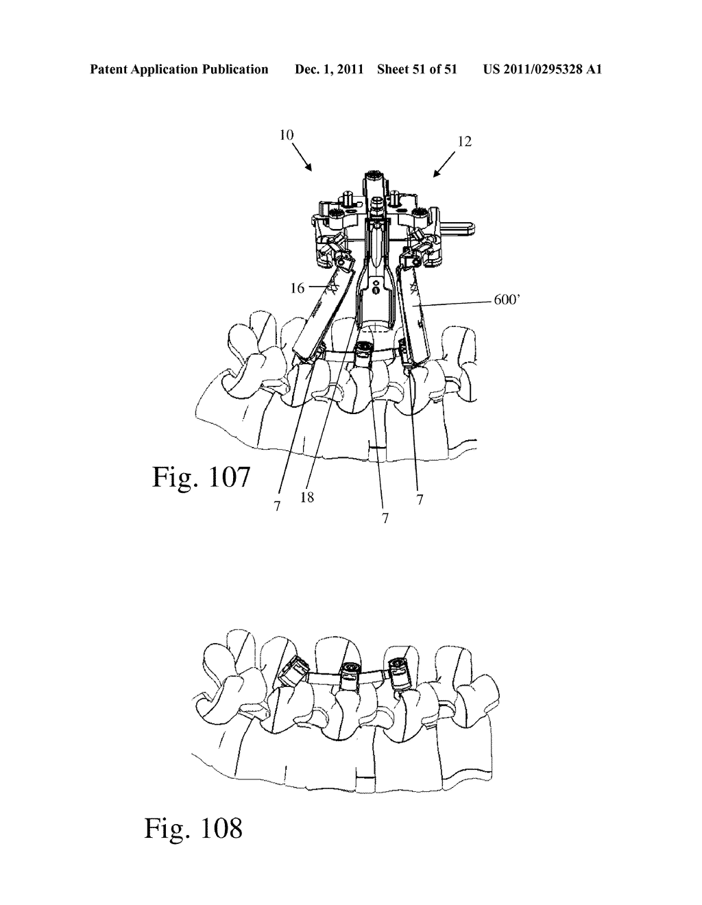 Method and Apparatus for Performing Spinal Surgery - diagram, schematic, and image 52