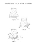 Patient Selectable Joint Arthroplasty Devices and Surgical Tools diagram and image