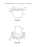 Patient Selectable Joint Arthroplasty Devices and Surgical Tools diagram and image