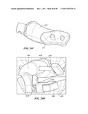 Patient Selectable Joint Arthroplasty Devices and Surgical Tools diagram and image