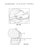 Patient Selectable Joint Arthroplasty Devices and Surgical Tools diagram and image