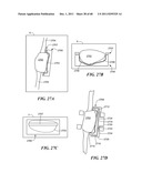 Patient Selectable Joint Arthroplasty Devices and Surgical Tools diagram and image