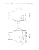 Patient Selectable Joint Arthroplasty Devices and Surgical Tools diagram and image