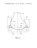 Patient Selectable Joint Arthroplasty Devices and Surgical Tools diagram and image