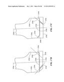 Patient Selectable Joint Arthroplasty Devices and Surgical Tools diagram and image