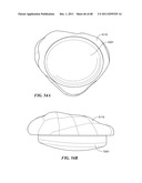 Patient Selectable Joint Arthroplasty Devices and Surgical Tools diagram and image