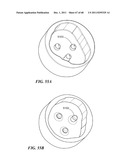 Patient Selectable Joint Arthroplasty Devices and Surgical Tools diagram and image