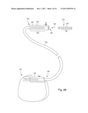 ANCHORING UNITS FOR LEADS OF IMPLANTABLE ELECTRIC STIMULATION SYSTEMS AND     METHODS OF MAKING AND USING diagram and image