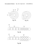 ANCHORING UNITS FOR LEADS OF IMPLANTABLE ELECTRIC STIMULATION SYSTEMS AND     METHODS OF MAKING AND USING diagram and image