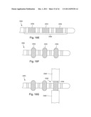 ANCHORING UNITS FOR LEADS OF IMPLANTABLE ELECTRIC STIMULATION SYSTEMS AND     METHODS OF MAKING AND USING diagram and image