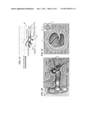 LASER-BASED NERVE STIMULATORS FOR, E.G., HEARING RESTORATION IN COCHLEAR     PROSTHESES AND METHOD diagram and image