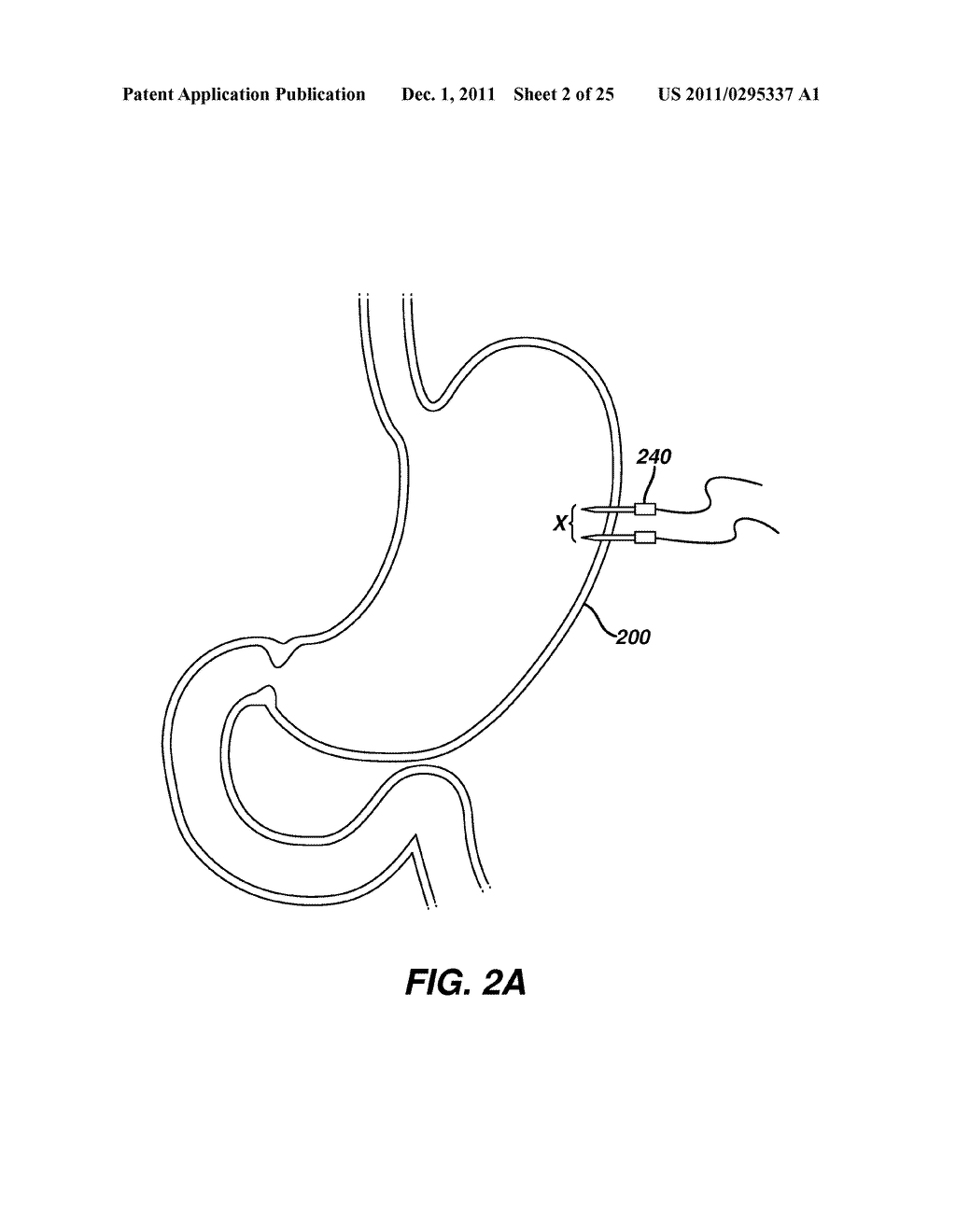 Systems and Methods For Regulating Metabolic Hormone Producing Tissue - diagram, schematic, and image 03