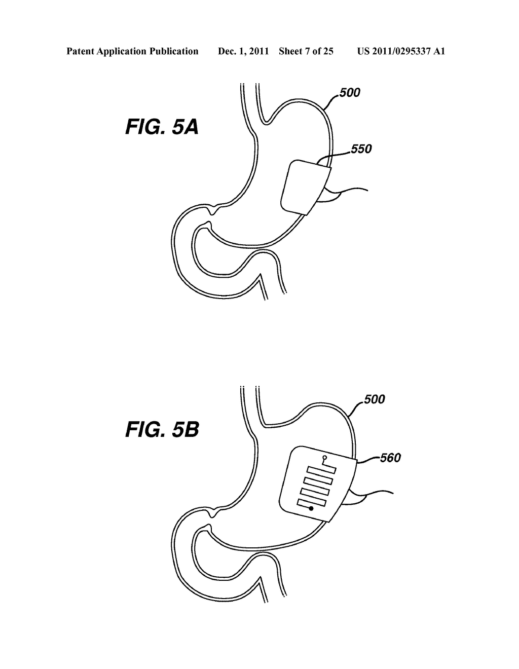 Systems and Methods For Regulating Metabolic Hormone Producing Tissue - diagram, schematic, and image 08