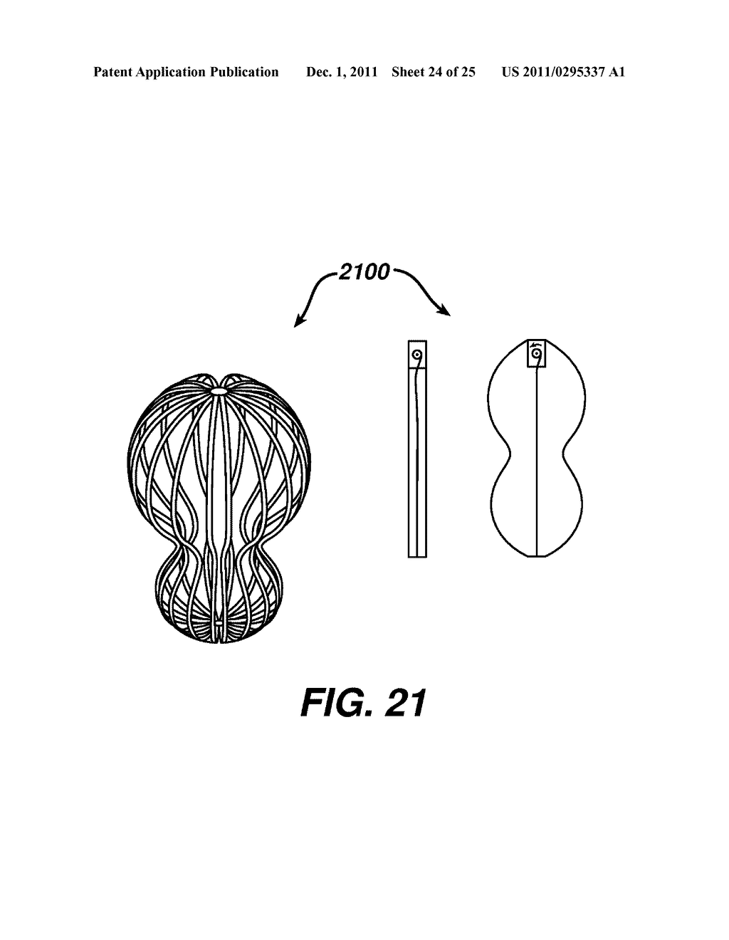 Systems and Methods For Regulating Metabolic Hormone Producing Tissue - diagram, schematic, and image 25