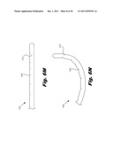 Cochlear Lead diagram and image