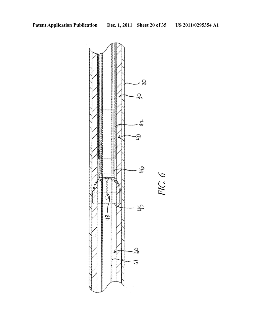 STENT DELIVERY SYSTEM WITH PUSHER ASSEMBLY - diagram, schematic, and image 21