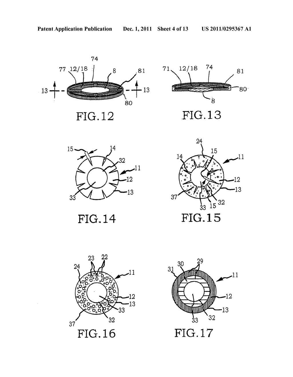 Intraocular implant cell migration inhibition system - diagram, schematic, and image 05