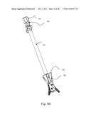 BI-DIRECTIONAL FIXATING TRANSVERTEBRAL BODY SCREWS AND POSTERIOR CERVICAL     AND LUMBAR INTERARTICULATING JOINT CALIBRATED STAPLING DEVICES FOR SPINAL     FUSION diagram and image