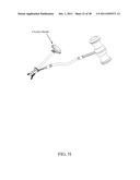 BI-DIRECTIONAL FIXATING TRANSVERTEBRAL BODY SCREWS AND POSTERIOR CERVICAL     AND LUMBAR INTERARTICULATING JOINT CALIBRATED STAPLING DEVICES FOR SPINAL     FUSION diagram and image