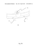 BI-DIRECTIONAL FIXATING TRANSVERTEBRAL BODY SCREWS AND POSTERIOR CERVICAL     AND LUMBAR INTERARTICULATING JOINT CALIBRATED STAPLING DEVICES FOR SPINAL     FUSION diagram and image