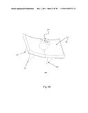 BI-DIRECTIONAL FIXATING TRANSVERTEBRAL BODY SCREWS AND POSTERIOR CERVICAL     AND LUMBAR INTERARTICULATING JOINT CALIBRATED STAPLING DEVICES FOR SPINAL     FUSION diagram and image