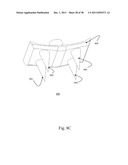 BI-DIRECTIONAL FIXATING TRANSVERTEBRAL BODY SCREWS AND POSTERIOR CERVICAL     AND LUMBAR INTERARTICULATING JOINT CALIBRATED STAPLING DEVICES FOR SPINAL     FUSION diagram and image