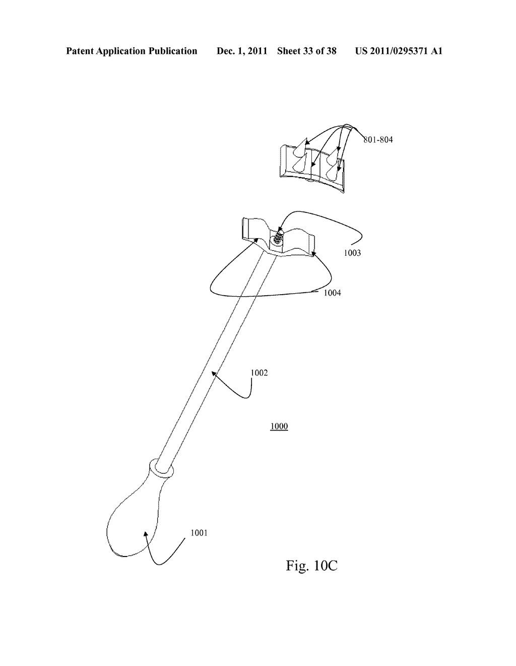 BI-DIRECTIONAL FIXATING TRANSVERTEBRAL BODY SCREWS AND POSTERIOR CERVICAL     AND LUMBAR INTERARTICULATING JOINT CALIBRATED STAPLING DEVICES FOR SPINAL     FUSION - diagram, schematic, and image 34