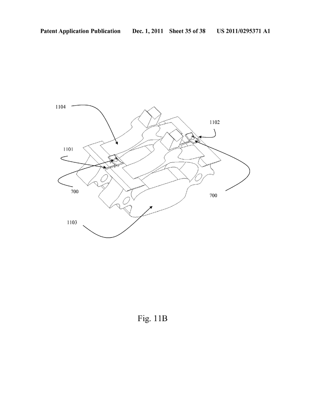 BI-DIRECTIONAL FIXATING TRANSVERTEBRAL BODY SCREWS AND POSTERIOR CERVICAL     AND LUMBAR INTERARTICULATING JOINT CALIBRATED STAPLING DEVICES FOR SPINAL     FUSION - diagram, schematic, and image 36