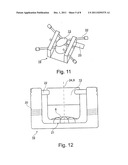 Allogenic Articular Cavity Prosthesis and Method for Implanting the Same diagram and image