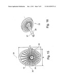 Allogenic Articular Cavity Prosthesis and Method for Implanting the Same diagram and image