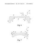 SEMI-CONSTRAINED ANKLE PROSTHESIS HAVING A ROTATING BEARING INSERT diagram and image