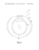 SEMI-CONSTRAINED ANKLE PROSTHESIS HAVING A ROTATING BEARING INSERT diagram and image