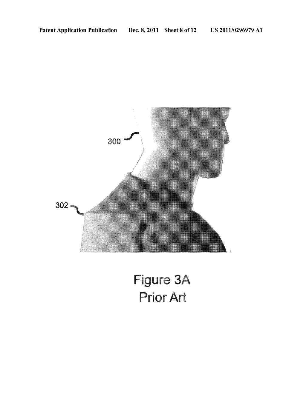 TITANIUM MOSAIC BODY ARMOR ASSEMBLY - diagram, schematic, and image 09