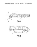 INTRAORAL FERRULE diagram and image