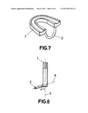 INTRAORAL FERRULE diagram and image