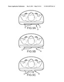 SURGICAL DRAPE WITH SEPARABLE ELEMENTS diagram and image