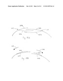 SURGICAL DRAPE WITH SEPARABLE ELEMENTS diagram and image