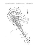 Surgical Stapler diagram and image