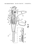 Surgical Stapler diagram and image