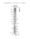 Surgical Stapler diagram and image